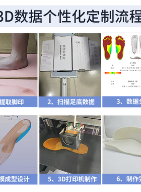 定制3D打印扁平足矫正鞋垫儿童内外八字足外翻成人足弓支撑XO型腿