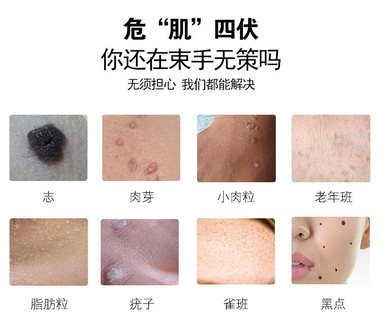 点痣祛斑笔无痛激光扫斑仪器洗纹身去脂肪粒疣子痦子点斑药水机器_虎窝淘
