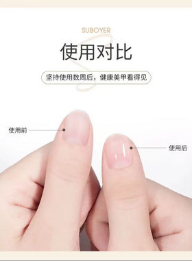 美甲营养油笔指缘滋润防倒刺护理