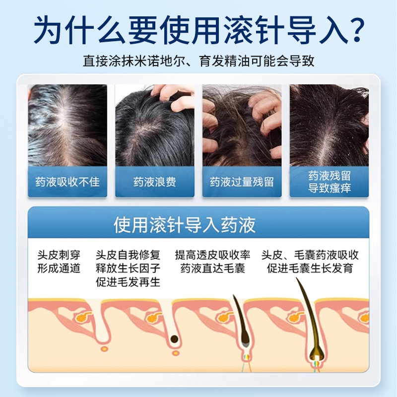 滚针医用械字号米诺地尔头皮上药器微针滚轮生发一次性酊泡沫剂液 - 图0