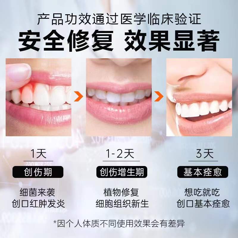 益生菌漱口水杀菌口臭抗菌牙结石 天天特卖工厂店漱口水