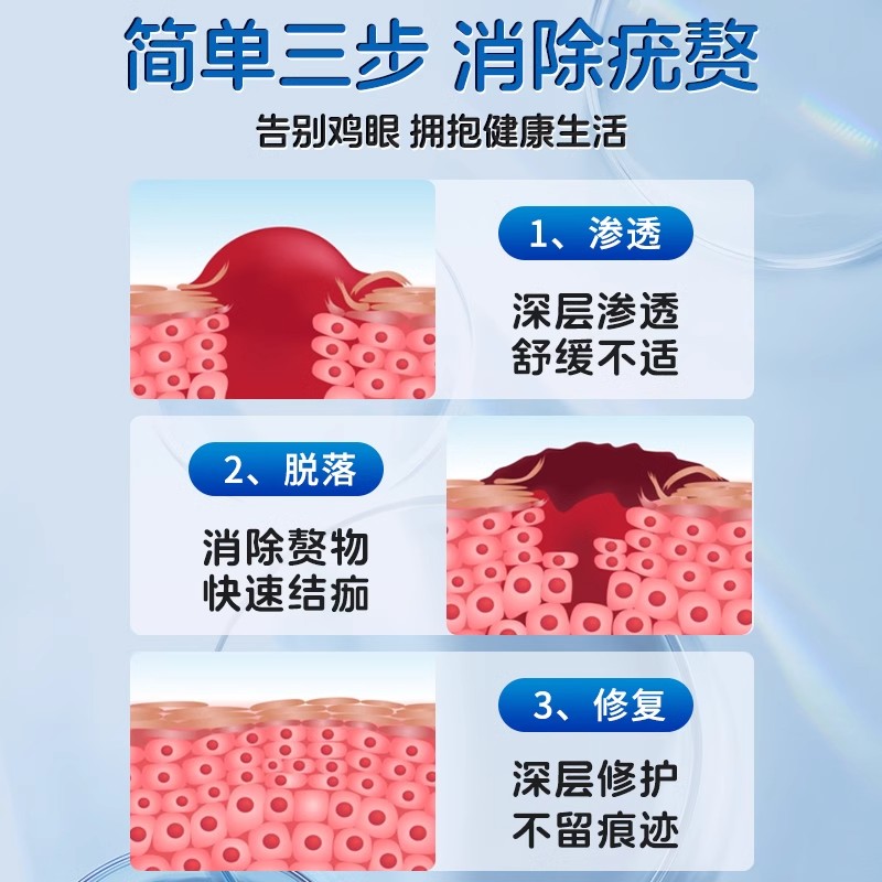 北京同仁堂鸡眼膏鸡眼贴非去除扁平疣跖疣瘊子疣老茧肉刺脚底祛除 - 图1