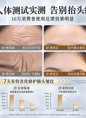 仁和匠心淡化抬头纹贴片面膜