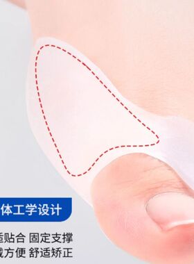 拇指外翻矫正器分趾器大脚趾头足可穿鞋男女脚趾分离器固定脚骨