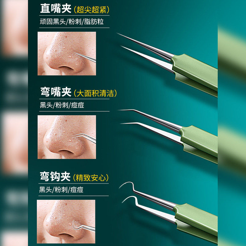 美容院级粉刺针 黑头粉刺清除工具细胞夹四件套组合闭口痘痘处理,淘宝优惠券,粉丝福利购,淘宝优惠卷