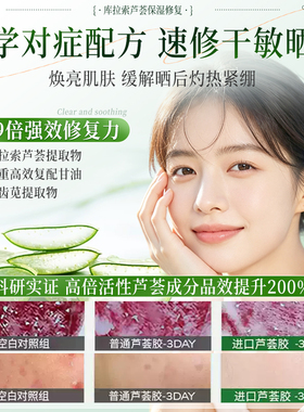 芦荟胶晒后修复补水保湿青少年军训祛痘印淡化痘印官方旗舰店正品
