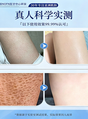 去鸡皮果酸身体乳500g