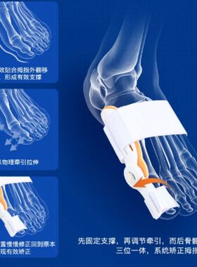 脚趾矫正器拇外翻男女士分离器大脚骨突出神器大母趾头足指姆矫形