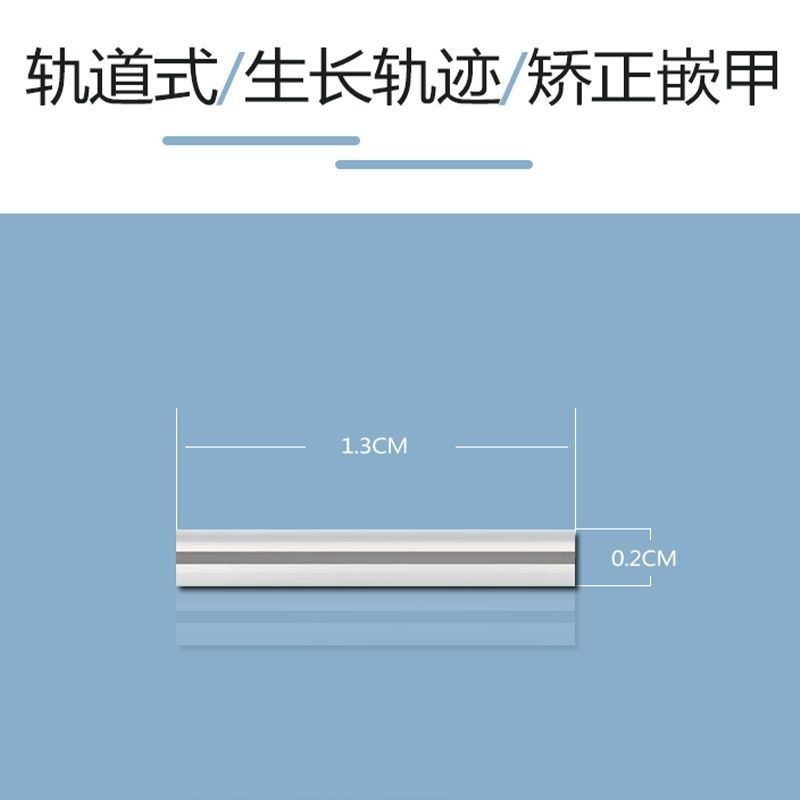 甲沟矫正器嵌甲矫正器脚趾甲卷指甲纠正正甲扣拉拉炎正甲贴片 - 图2