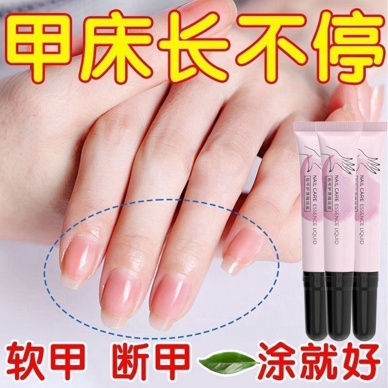 指甲护理精华液护甲营养液修复甲床增厚甲油胶生长封层指缘手指 - 图1