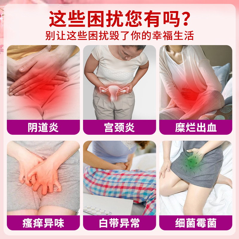 修正壳聚糖医用妇科凝胶霉菌性宫颈阴道炎白带异外阴瘙痒专用冲洗