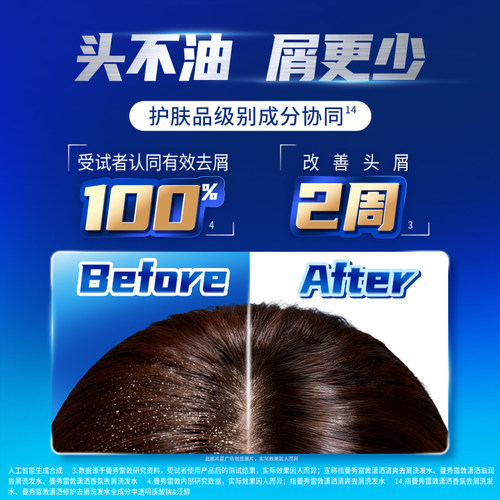 【官方正品】曼秀雷敦selsun潇洒二硫化硒去屑洗发水蓬松头皮止痒 - 图3