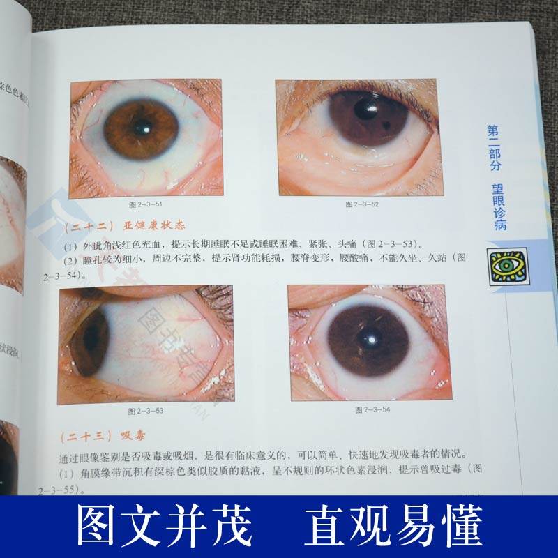 官方正版 中医望诊彩色图谱【附光盘】中医望诊辩证图册图解大全 眼耳口手望闻问切实用案例分析 中医学书籍 中医望诊书籍_虎窝淘