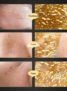 Images Gold To Black Mask Remove Black Spots Stains Face Por