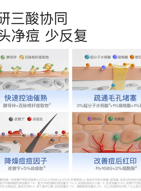 奢思雅清润祛痘精华液点痘笔