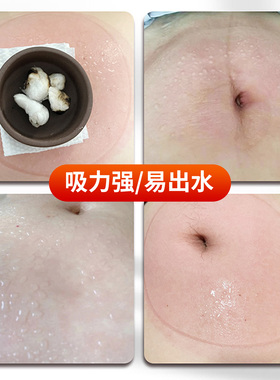 紫砂温阳罐大罐脐灸罐中医扶阳罐