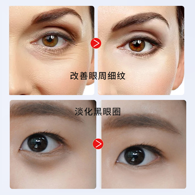 蛇毒正品抗皱去除淡化黑眼圈眼霜 花琪眼霜