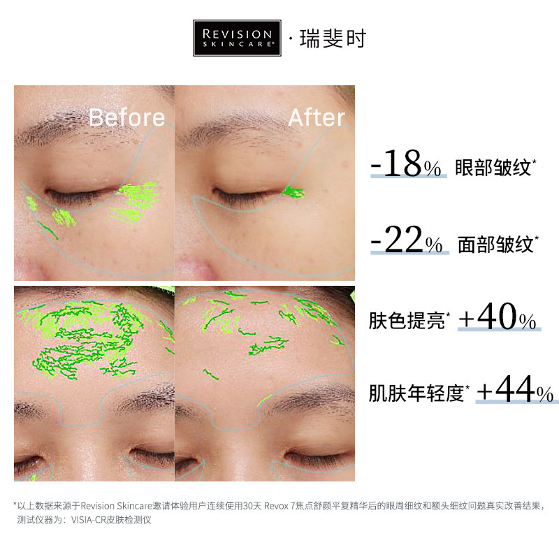 revisionskincare瑞斐时眼部精华液 revisionskincare海外液态精华