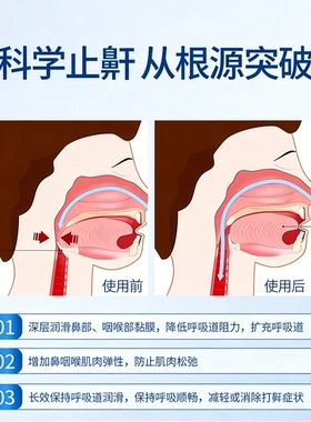 【Lxyxx正品】同款鼻贴防神器呼噜贴张嘴睡觉打鼾不通男女通用