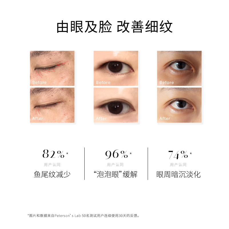 淡化细纹黑眼圈去水浮肿 VC 醇 A 眼霜 A 晚 C 毕生之研甄 骆王宇专享 淡化细纹黑眼圈去水浮肿 VC 醇 A 眼霜 A 晚 C 毕生之研甄 骆王宇专享