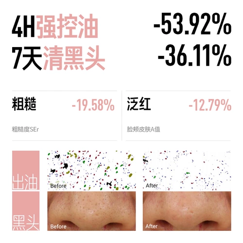 Очищающее молочко с салициловой кислотой, маска для лица от черных точек для жирной кожи, сужает поры