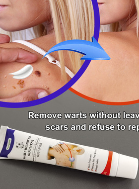 Wart Remover Cream祛wart膏 Wish 亚马逊 Ebay Lazada 20g