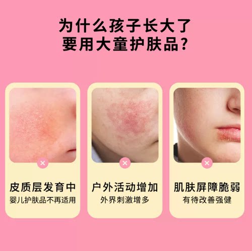 musefriends儿童舒缓保湿面霜大童滋润四季补水春秋冬面霜润肤乳 - 图1
