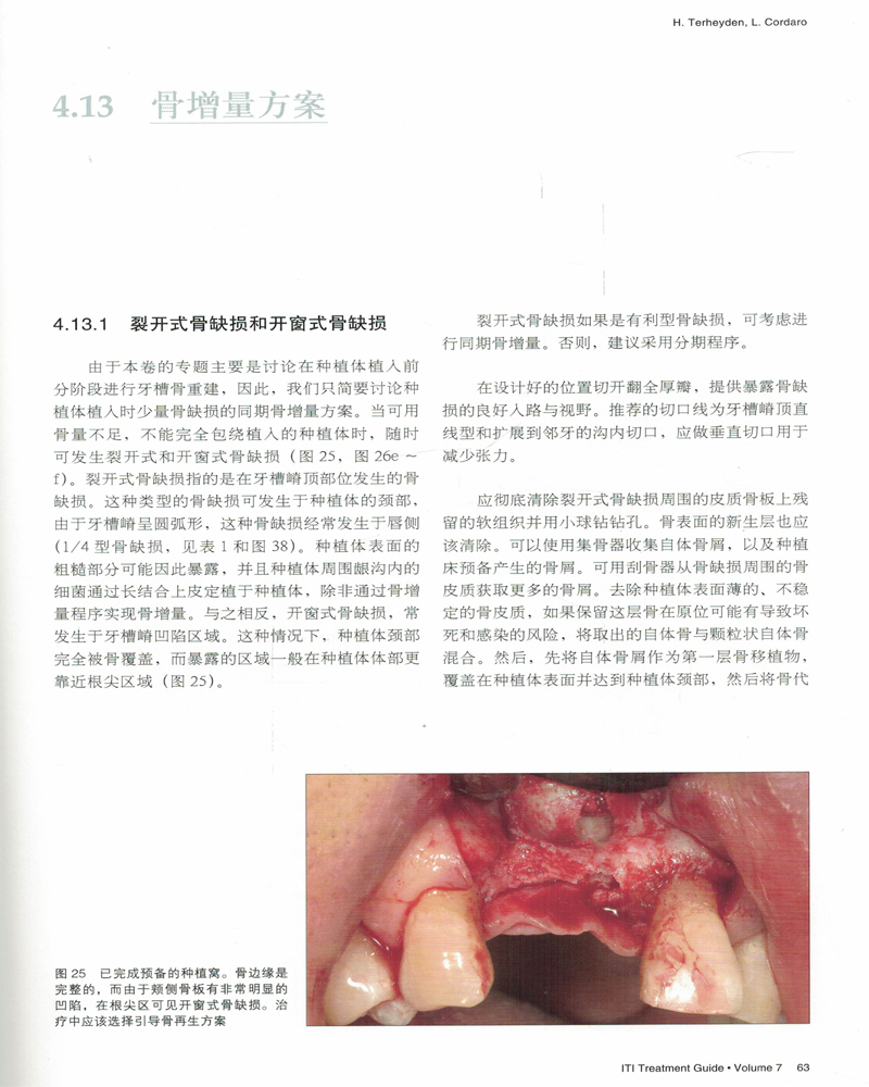 正版现货 口腔种植的牙槽嵴骨增量程序:分阶段方案 第七卷[意]卢卡·科达罗[意]亨德里克·特海主编 宿玉成主译 辽宁科学技术出版 - 图2