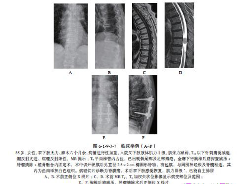 正版现货 现代脊柱外科学(第三版)共六册 赵定麟主编 世界图书出版公司 - 图1