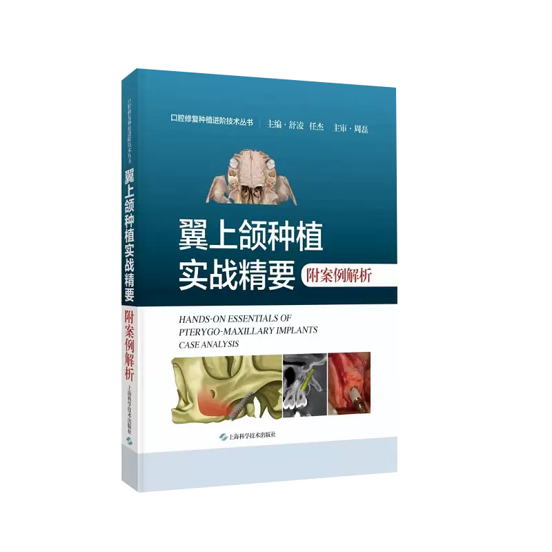 两本套 翼上颌种植实战精要附案例解析/翼上颌种植 循证与创新 舒凌 任杰 史俊宇 赖红昌等主编 口腔修复种植进阶技术 口腔书籍
