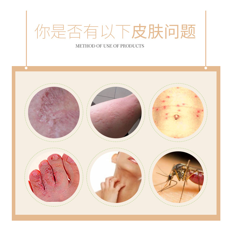 广益百草堂抑止菌痒百消王百消膏 大脑袋医疗器械皮肤消毒护理（消）