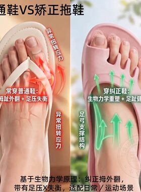 德国拇指外翻脚趾矫正器五趾拖鞋足弓支撑脚趾分离拇外翻固定男女