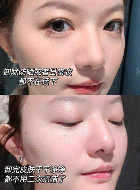 咔咔卸妆~贝德玛水敏感肌