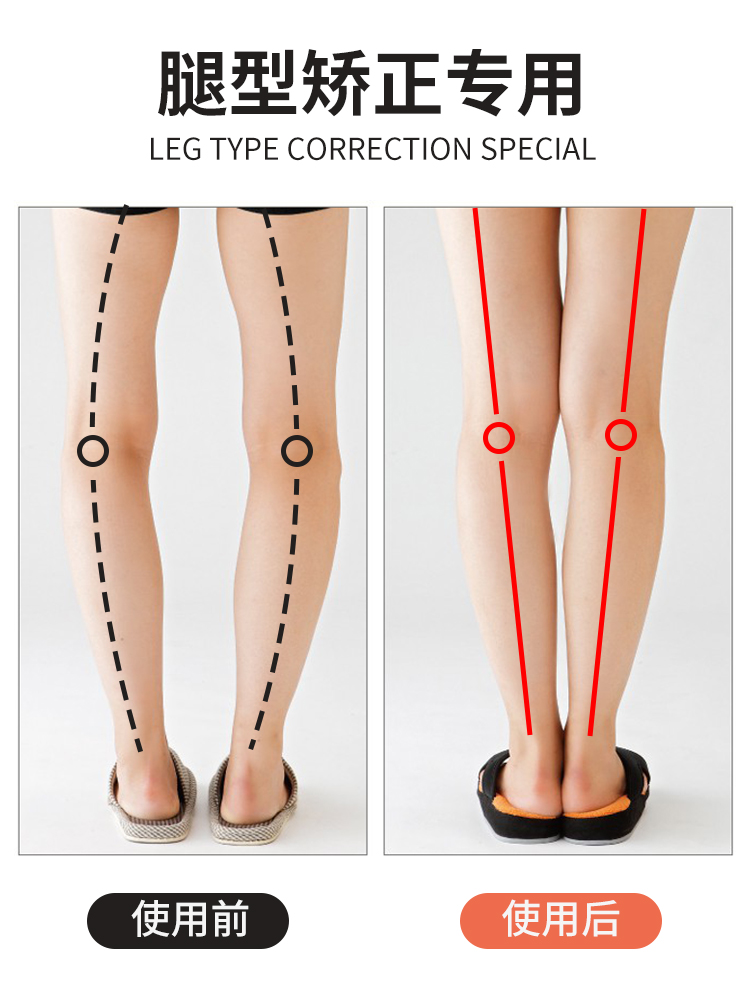 女团腿神器弯腿欧型腿0型腿矫正器外八字脚矫正器大人火山石鞋垫-图0