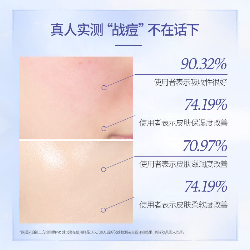 汝新美肌焕活新肌寡肽冻干粉精华液舒缓修护屏障改善泛红 - 图2