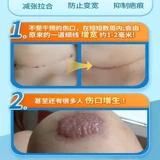 Уменьшение публикации для детских ранних ран