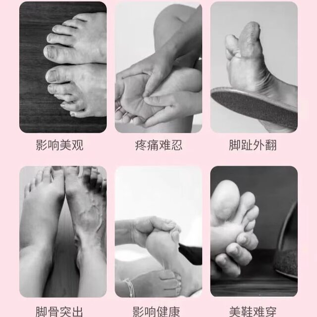 Fascial arch trainer (medium hardness) home exercise to highlight girls' exercise to upgrade toe assistance