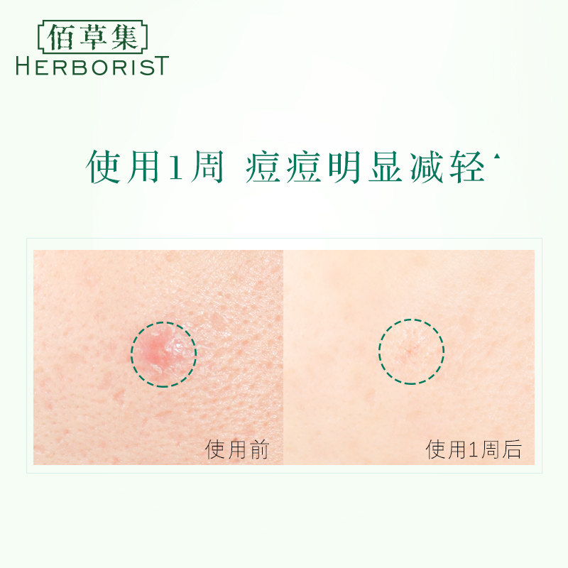 佰草集舒盈祛痘75ml清爽水润调理乳 佰草集美策乳液/面霜