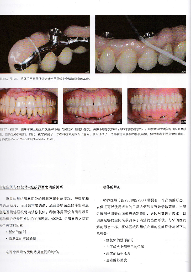 正版现终末期牙列种植修复的临床和技术指南适用于种植医生修复医生学习列奥内罗比斯卡罗主编辽宁科学技术出版社9787559119827-图3