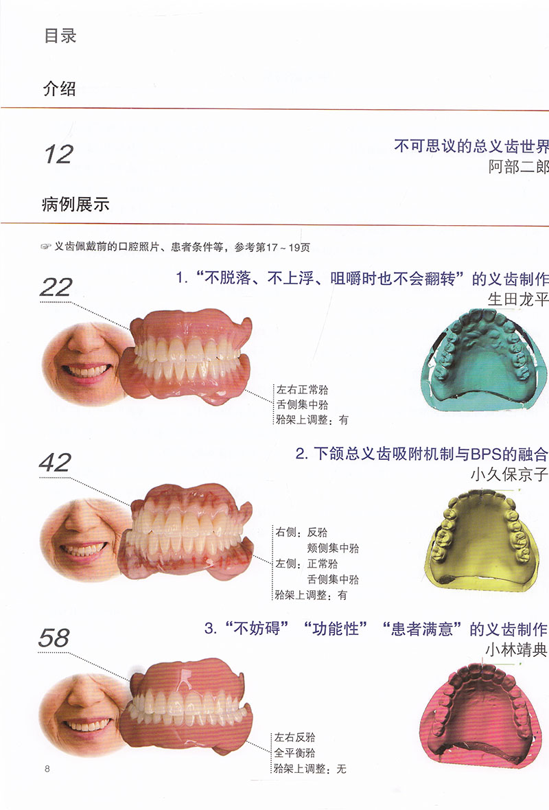 现货具有稳定咬合的总义齿形态 对临床有非常强的指导意义 口腔科学书籍生田龙平小久保京子等著辽宁科学技术出版社9787559119681