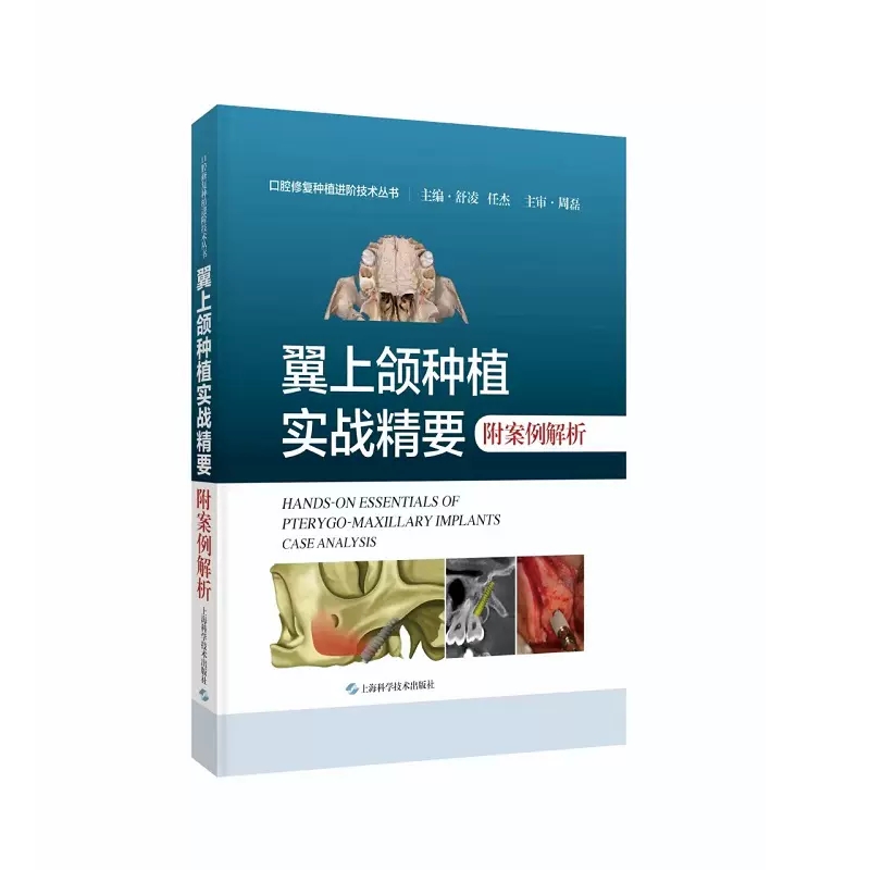 正版 翼上颌种植实战精要 附案例解析 舒凌 任杰 主编 上海科学技术出版社9787547865705