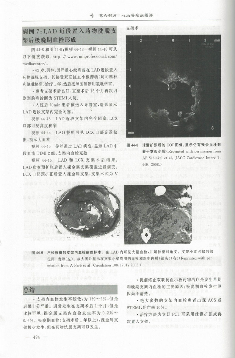 现货 哈里森心血管病学 中文翻译版 原书第2版二 美 约瑟夫 洛斯卡奥Joseph Loscalzo医学经典专著病 韩雅玲院士内科学科学出版社