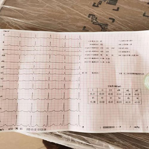 ECG-3312三锐心电图机单三六十二十八道自动分析医用家用便携导联 - 图2
