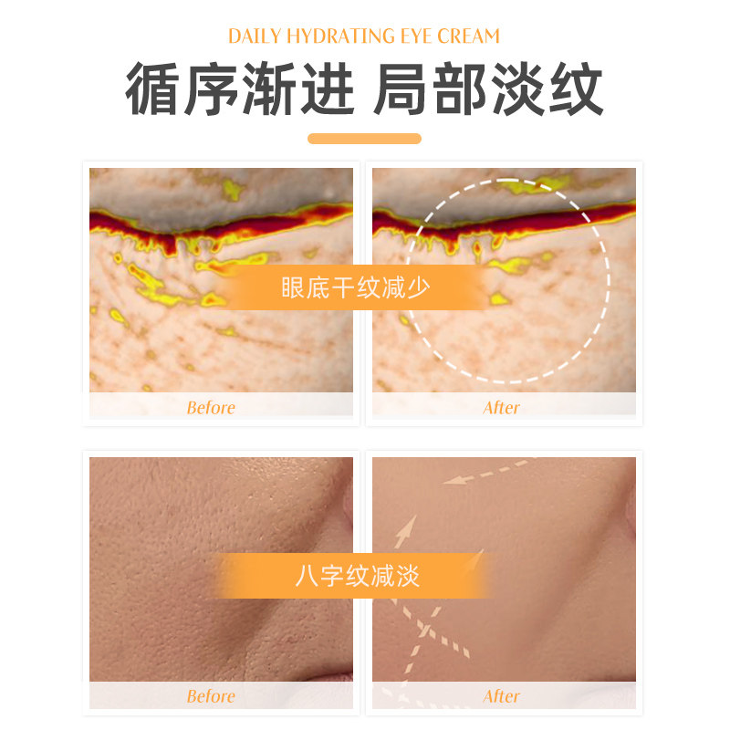 【首页入会】dh德国世家眼部膏去眼纹 drhauschka海外眼霜