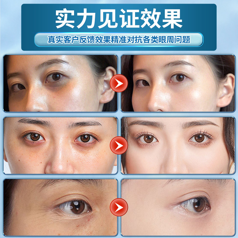 仁和匠心蛇毒淡化细纹眼圈眼膜贴 药都仁和眼膜