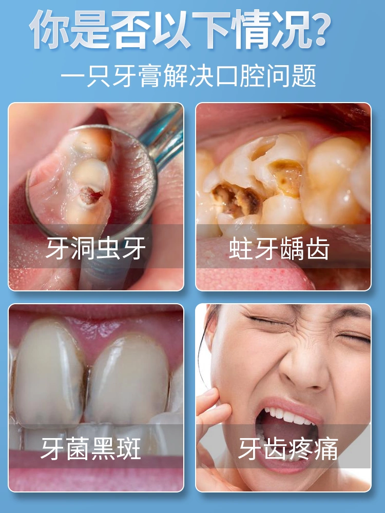 补牙神器自己在家补牙齿洞膏补牙缝堵牙洞神器蛀牙洞清理牙虫的药 - 图1