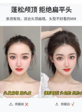 假发片女头顶补发蓬松增发量垫发片后脑勺假发贴片高颅顶扁头神器