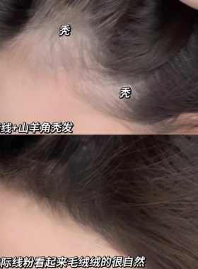 3D立体发际线粉填充神器补发防水防汗发髻线修容阴影自然遮高额头