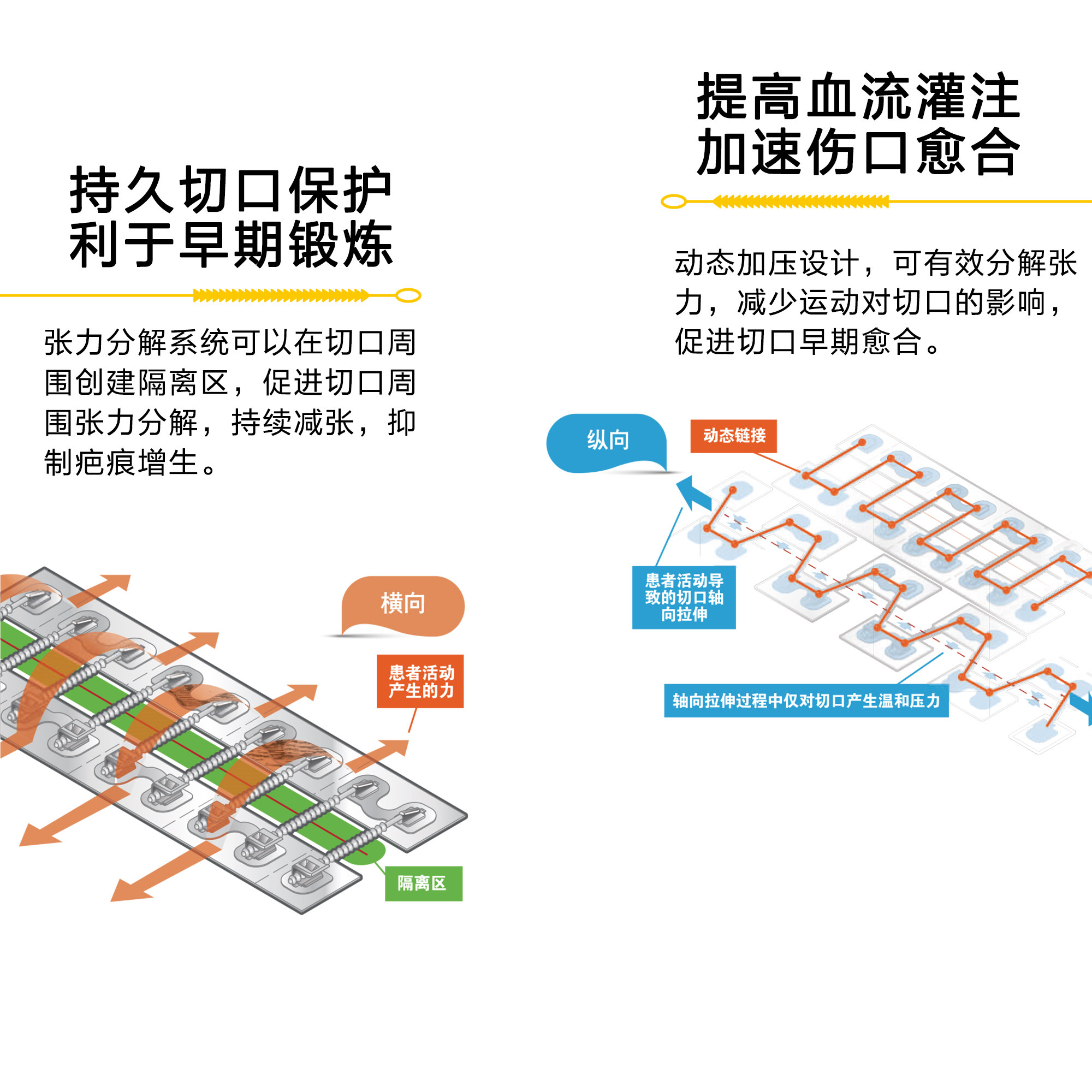 美国进口医用zipline减张器史赛克一次性皮肤缝合器stryker史塞克-图2