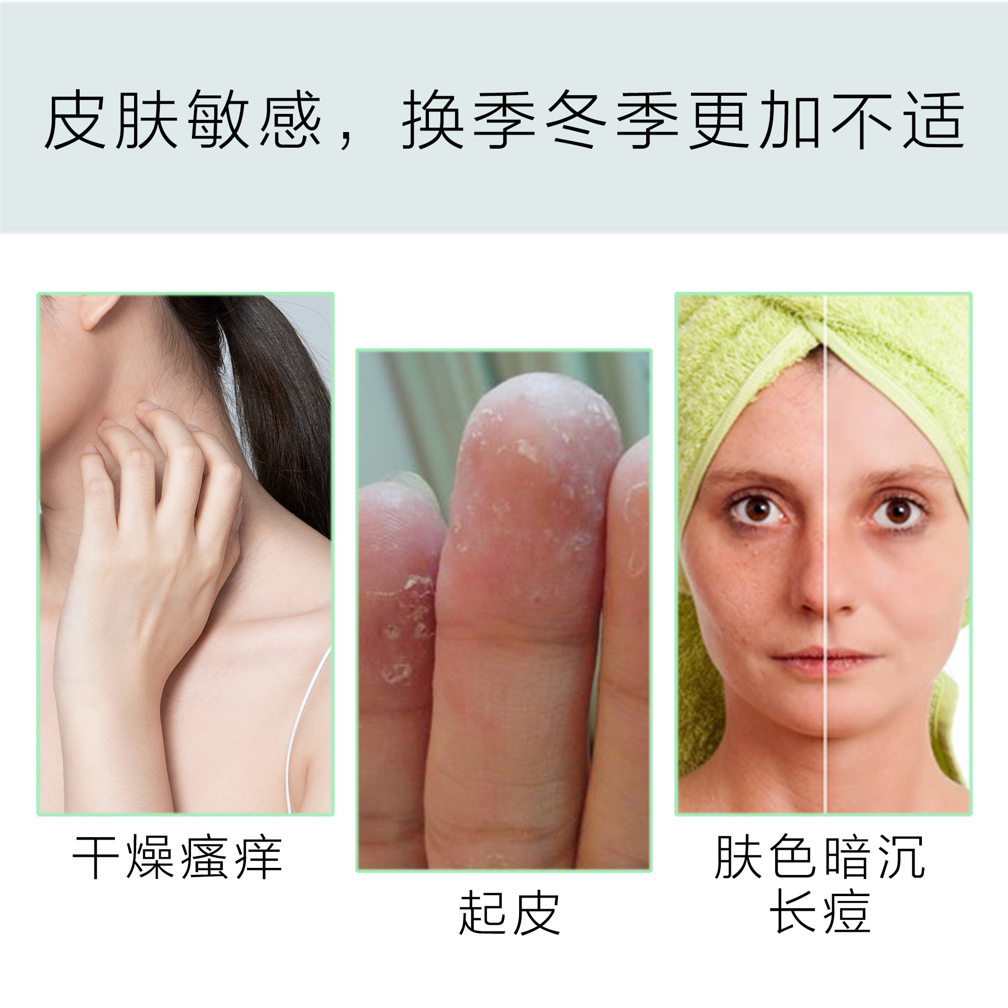 普芙清皮肤护理液改善敏感性皮肤引起的脱皮瘙痒创面愈合皮肤干燥